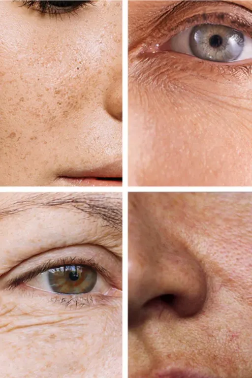 Peeling-medicale-visage