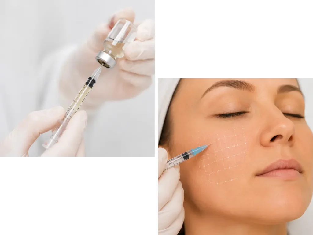 Mesotherapie